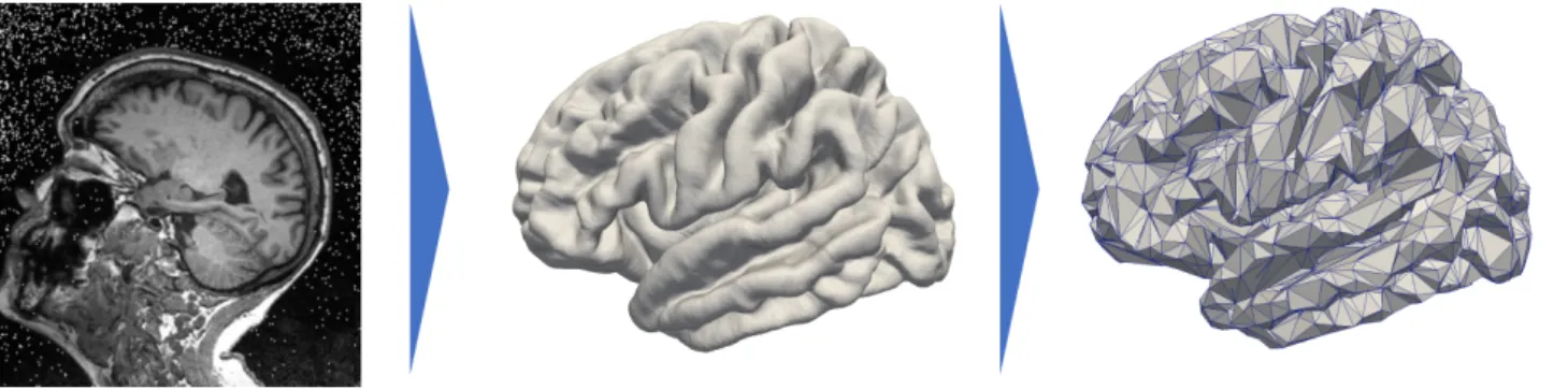 Figure 3.1: Data preprocessing that projects the cortical thickness of the raw MRI ob- ob-servation (left) on a mesh, namely the FSAverage atlas constituted of 163.842 nodes per hemisphere (middle) before sub-sampling it and averaging the signal onto a 182
