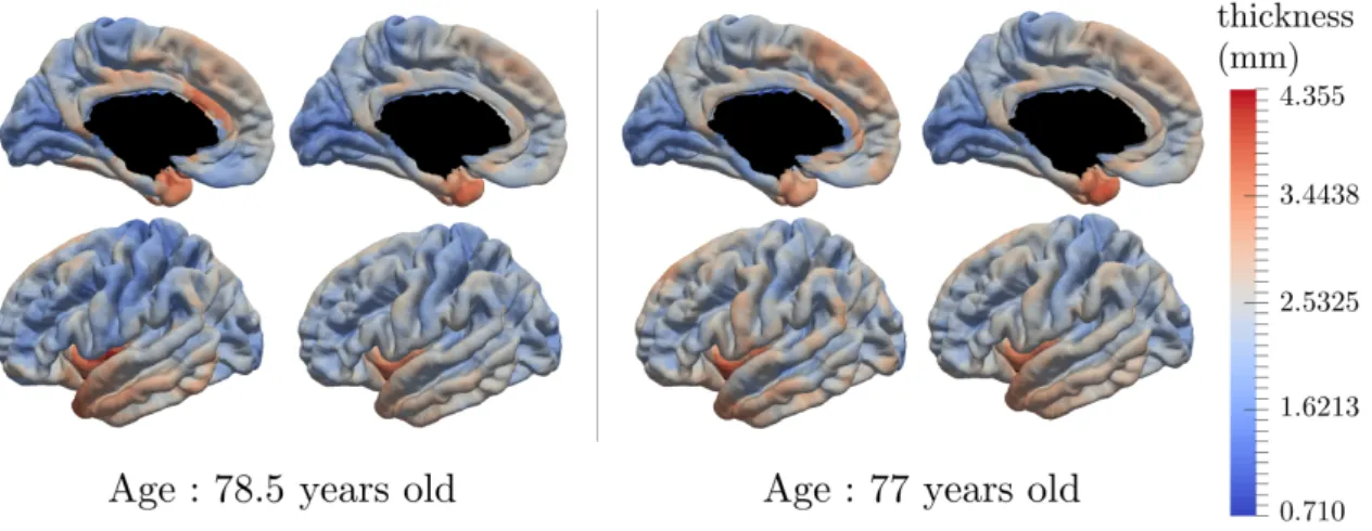 Figure 3.9: Real data and data reconstruction for subjects with a small space shift (right) and large space shift (left)