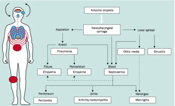 Figure 6. Différentes routes de pathogénicité de l’infection à pneumocoque (Source : Bogaert et al., 2004) 