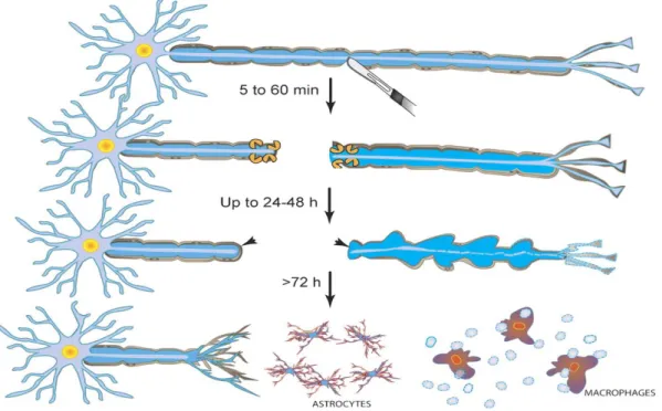 Figure 12 : Représentation schématique de la dégénérescence Wallérienne  (J. T. Wang et  al., 2012) 