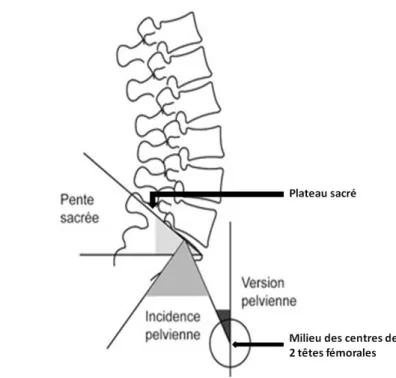 Figure 7. Les paramètres spino-pelviens (Gepner et al, 1994, modifiée) 