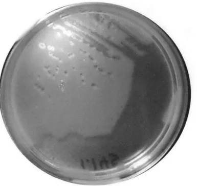 Figure 2.  Image  of single  plaques generated  by  streaking-for-singles  into molten  top  agar.