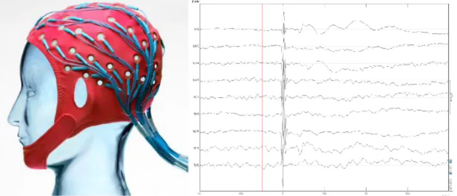 Figure  1-23 : Modèle de casque EEG et un aperçu des signaux captés par les électrodes (potentiel en µV) 