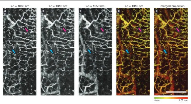 Figure 3. The vascular projections acquired from the bands centered at (a) 1060 nm, (b) 1310 nm, and (c) 1550 nm are shown