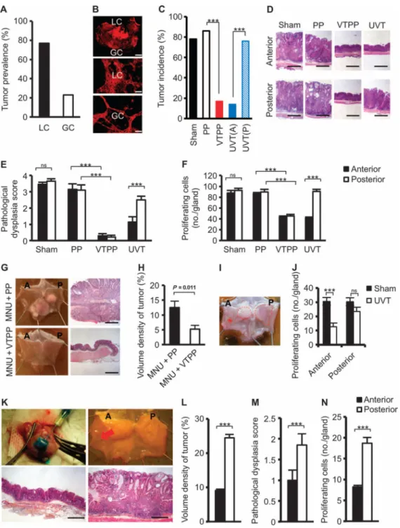 Fig. 1. Denervation attenuates tumorigenesis at the preneoplastic stage in mouse models of  gastric cancer