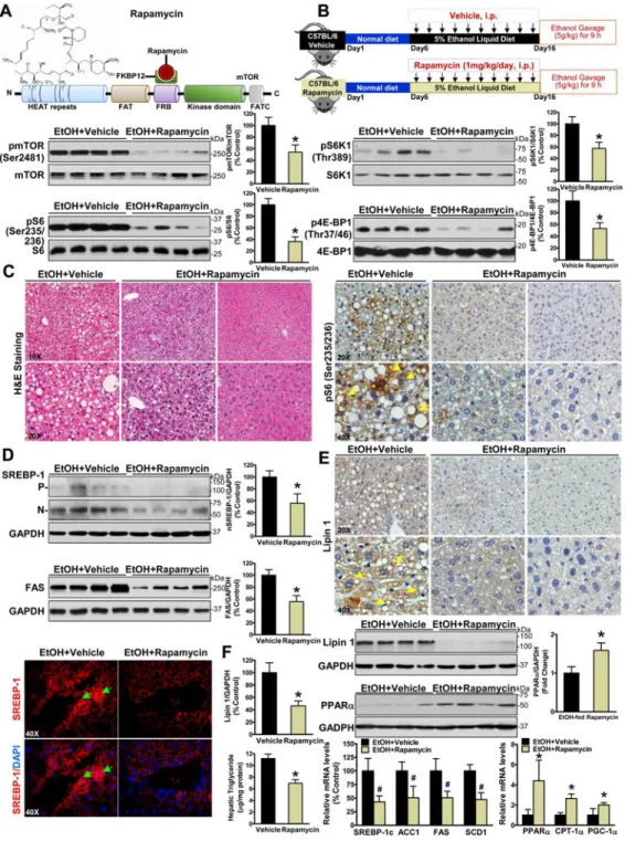Fig. 4. Pharmacologic intervention via mTORC1 inhibition reduces hepatic lipogenesis,  stimulates fatty acid oxidation, and ameliorates hepatic steatosis in chronic-binge ethanol-fed  mice