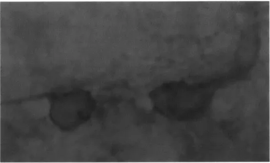 Figure  5:  Smoothing  (lixil  kernel)