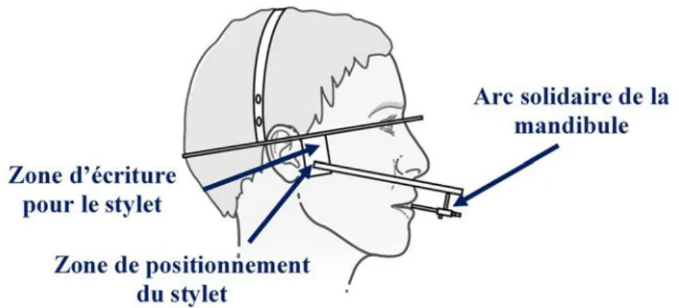 Figure 11 : Principe de l’axiographie [20] : tracé des trajectoires condyliennes lors de  mouvements mandibulaires 