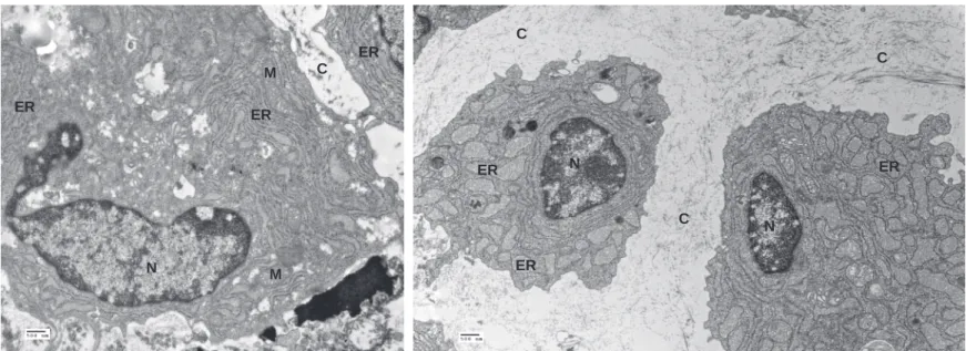 Figure  7:  Der2 -/-   chondrocytes  show  intracellular  retention  of  extracellular  matrix  proteins