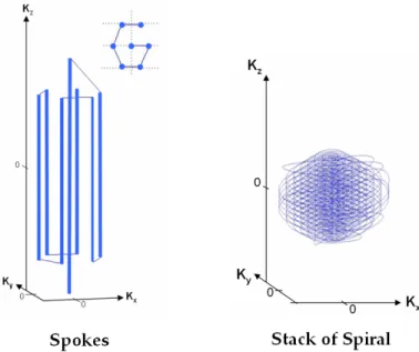 Figure 6: Spokes (left) and Stack of spiral (right) trajectories.  