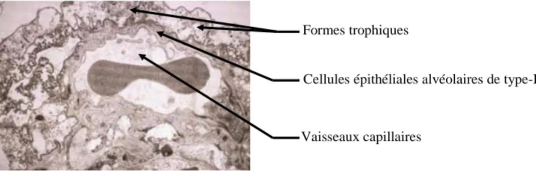 Figure 10 : Attachement de Pj aux cellules alvéolaires en microscopie électronique [Aliouat-Denis et al