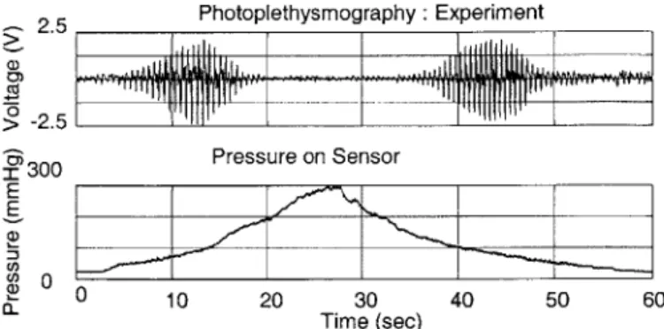 Figure 5-24  Photoplethysmography  and pressure at sensor  unit from experiment  in case  1