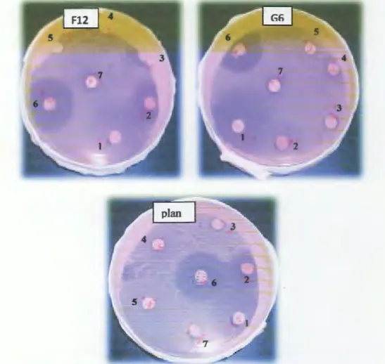 Figure 05:  inhibition zones for the susceptibility of  Lactobacillus strains to antibiotics