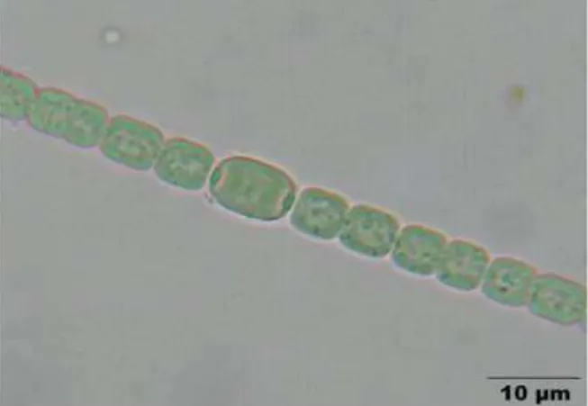 Figure 05 : Photographie d'une Cyanobactérie Anabaena(http://www.dr-ralf-wagner.de)  I.4