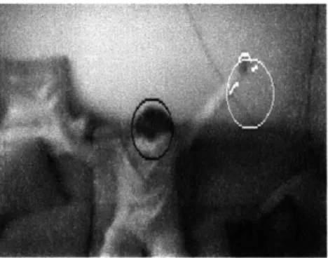 Figure  3-6:  Highest  Line  of  Coherent  Motion  Wide  Enough  to  be  a  Head  Where  the Resulting  Candidate  is a  False  Positive