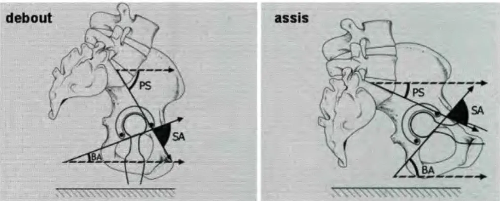Figure 11 : Variations de la pente sacrée et de la bascule acétabulaire en fonction de  la position debout ou assis