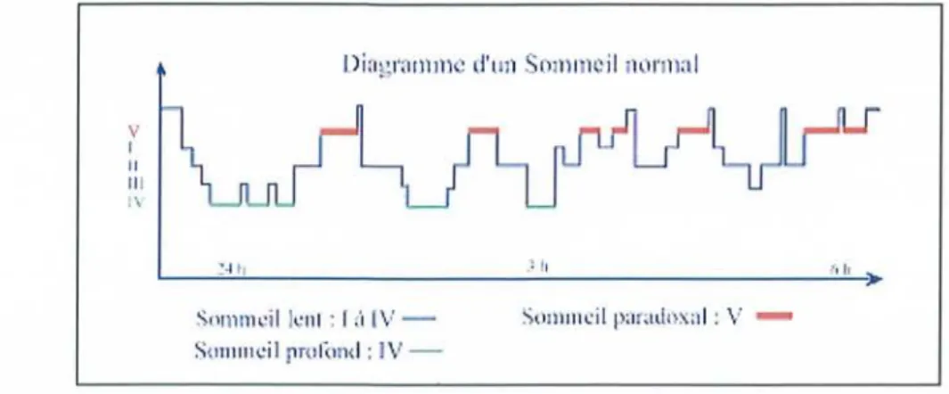 Figure 22: Diagramme d 'un sommeil normal.