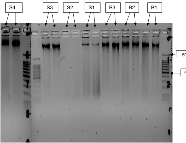 Figure 1 : Electrophorèse de l'ADN extrait des échantillons B1 à S4. Pour chaque échantillon, une  première élution est réalisée (colonne de droite), puis une seconde (colonne de gauche) 