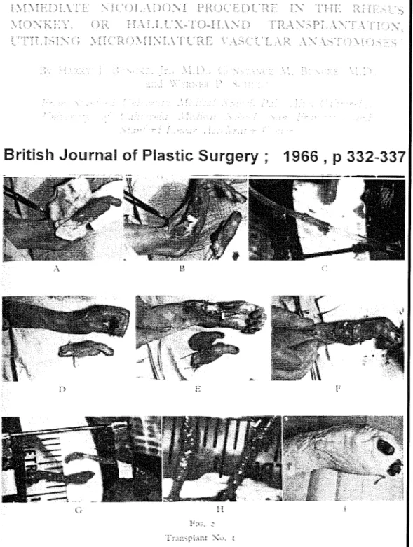 Figure 33  Article  princeps de Harry  Bunckee de  1966 du  transfert  de  l'haiiux  sur la  main  chez un singe rhesus sur 