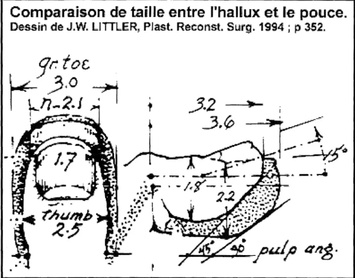 Figure 34  Dessin de J.W LITTLER  :  comparaison des dimensions de I'haiiux et du pouce