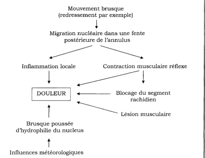 Tableau VIII - Mécanisme physiopathologique du lumbago.