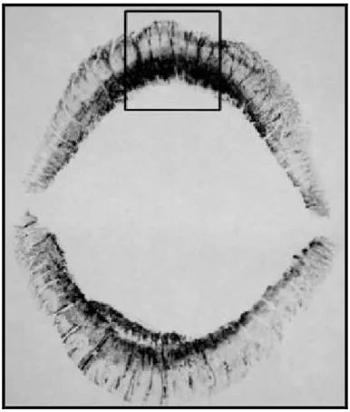 Figure 9 : photographie exposant une empreinte de lèvre appartenant à une femme originaire d’Arabie  Saoudite