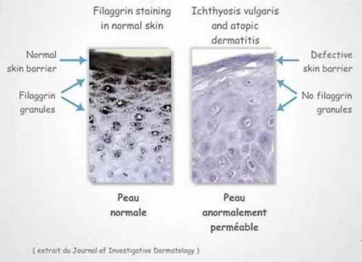 Figure 4 : Coupe d’une peau saine et atopique (Fda, 2016). 