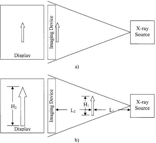 Figure 4.16:  Magnification  by  using cone-beam  x-ray  source.