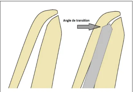 Figure 7 : Schématisation de l'angle de transition (www.dentalespace.com).