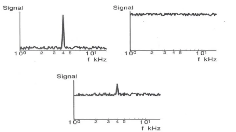 Figure 12 : Représentation de l'atténuation de l'intensité de l'acouphène grâce au bruit blanc [63] 