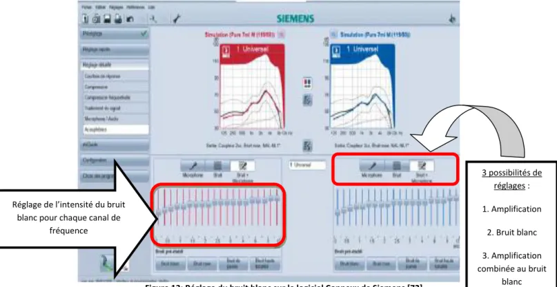 Figure 13: Réglage du bruit blanc sur le logiciel Connexx de Siemens [72] 