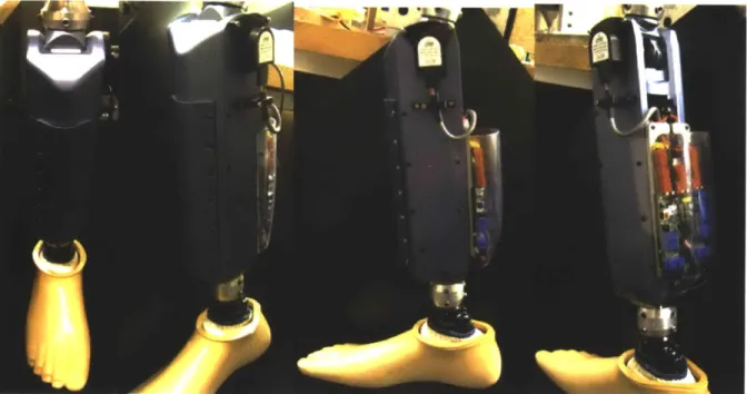 Figure 4.7-Biomimetic  agonist-antagonist  active knee prosthesis