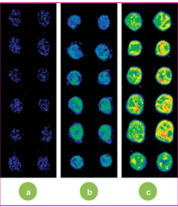 Figure 9 - Images de fluorescence (détails, fausses couleurs) d’une puce à ADN, réalisées dans les mêmes conditions de détection (même puissance d’excitation laser et même sensibilité à la détection), pour trois différents types de substrat : lame de verre