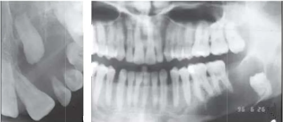 Figure 6 : A gauche  : Image