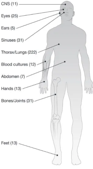Figure 7: Organes et tissus infectés par des souches du complexe Scedosporium  (Cortez et al