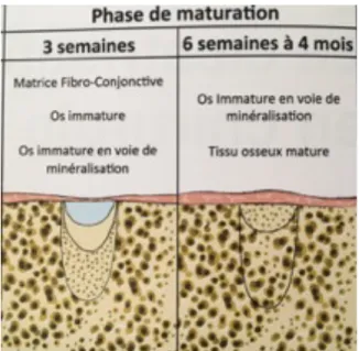 FIGURE 3 : PHASE DE MATURATION OSSEUSE  SOURCE : RÉALITÉS CLINIQUES «  LA CICATRISATION »