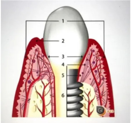 FIGURE 9 : VUE COMPARATIVE DE LA GENCIVE  ET DE LA MUQUEUSE PÉRI-IMPLANTAIRE 