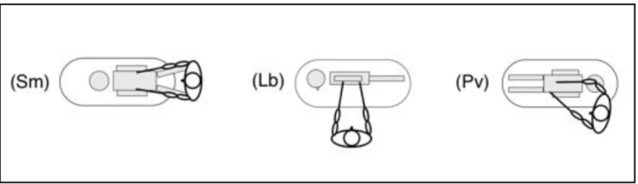 Figure 3 : Positions du chirurgien par rapport à la table opératoire pour les 3 situations les plus courantes en cœliochirurgie standard :  Sus-mésocolique (Sm), Lombaire (Lb) et Pelvien (Pv)