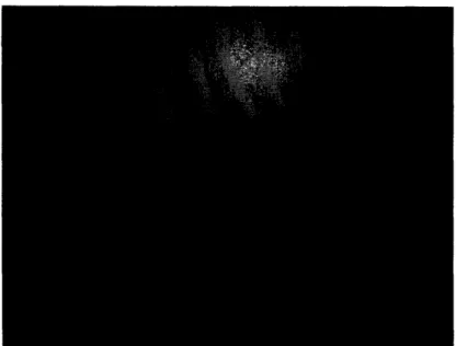Figure 3.7:  An example  of almar prehension