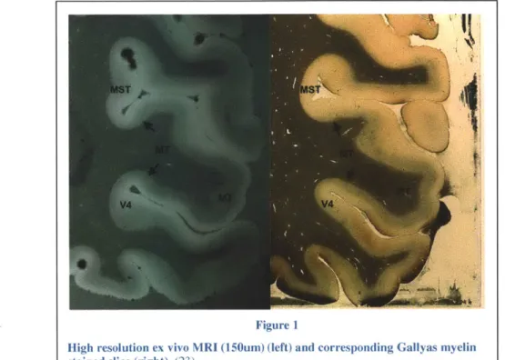 Figure  1 shows  and  MRI generated  &#34;slice&#34;  next to a  traditional sample  which is  manually  sliced,  stained, and  labeled