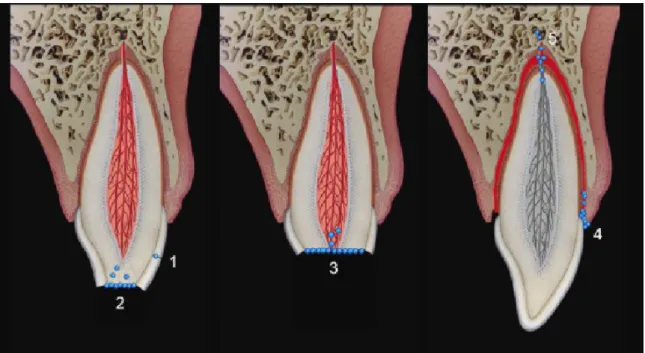 Figure  1  :  Voies  d’invasion  bactérienne  en  traumatologie  dentaire :  (1)  Fêlure  de  l’émail, (2) Tubuli dentinaires, (3) Invasion directe de la pulpe, (4) Invasion cervicale  du ligament alvéolo-dentaire, (5) Anachorèse