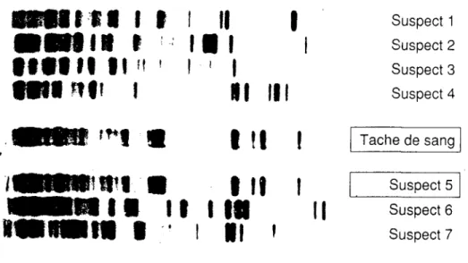 Figure 8 :Autoradiogramme d'une sonde multiloculaire. Les empreintes génétiques provenant du sang du suspect n05 correspondent exactement à celles issues de la tache de sang retrouvée sur les lieux du crime.Il s'agit donc de l'agresseur.