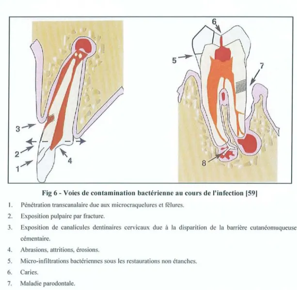 Fig 6 - Voies de contamination bactérienn e au cours d e l'infection 1 591