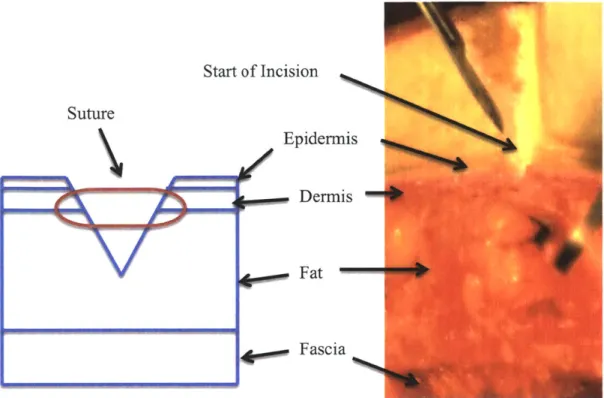 Figure 1.1:  Cross-section  of wound  showing  the layers  of skin. Left:  Model  of skin layers and placement  of surgical suture