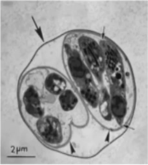 Figure  2:  Oocyste  sporulé  de  toxoplasme  observé  en  microscopie  électronique. 