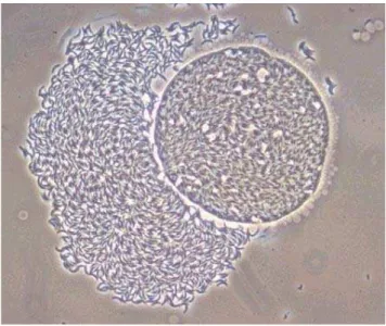Figure 4 : Rupture de la paroi d’un kyste et libération de centaines de bradyzoïtes sous  l’action des sucs digestifs (d’après Anofel)