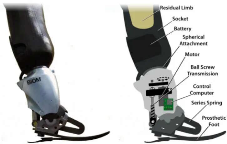 Fig 1. Schematic of bionic dancing prosthesis. Bionic ankle prosthesis shown (left) with major components highlighted (right)