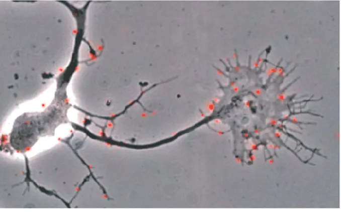 Fig. 2.6 – Exemple de marquage sur un neurone de trois jours en culture.