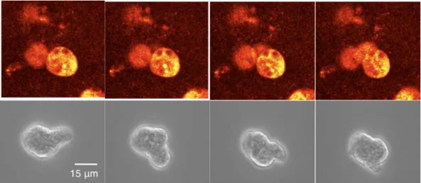 Fig. I.25: Motilité d’E. histolytica, in vivo (en haut) et in vitro (en bas) (resp. micro- micro-scopie à 2 photons et micromicro-scopie à contraste de phase, intervalle temporel entre images : 7,5 secondes)