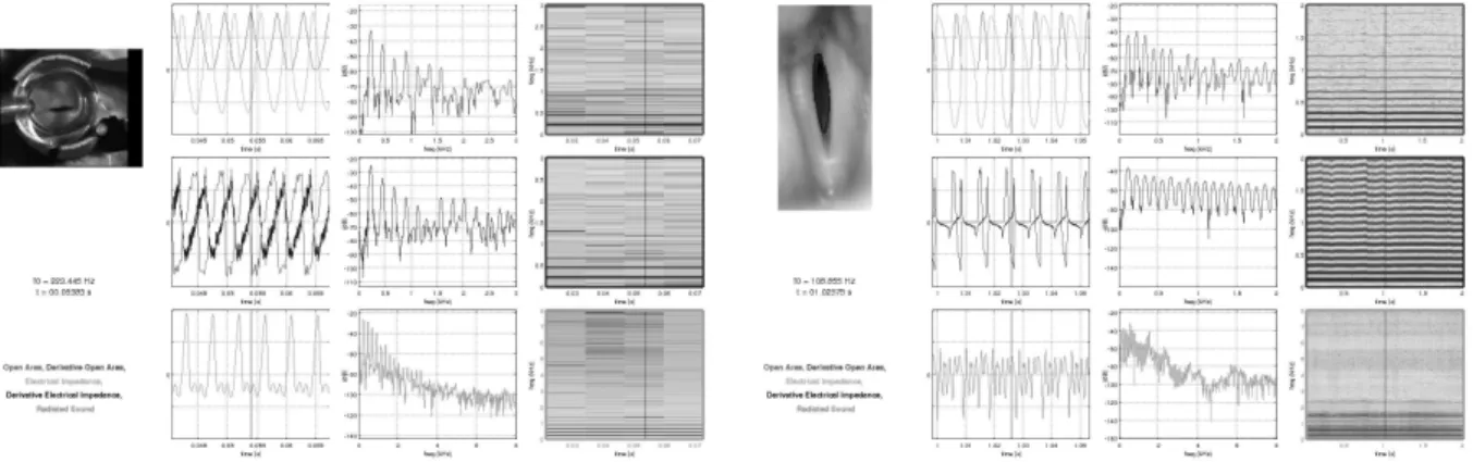 Figure 4.4 – Synchronous display of multimodal measurements of lips and glottis. Video samples are available on the corresponding author’s website [Hez].
